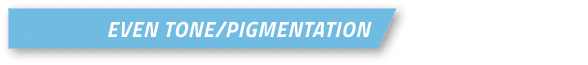 Even Tone/Pigmentatio