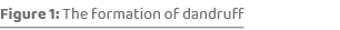 Figure 1: The formation of dandruf