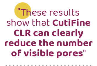 \“These results show that CutiFine CLR can clearly reduce the number of visible pores