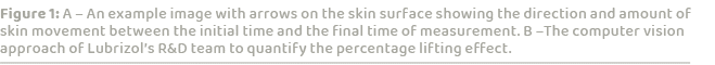 Figure 1: A – An example image with arrows on the skin surface showing the direction and amount of skin movement betw...