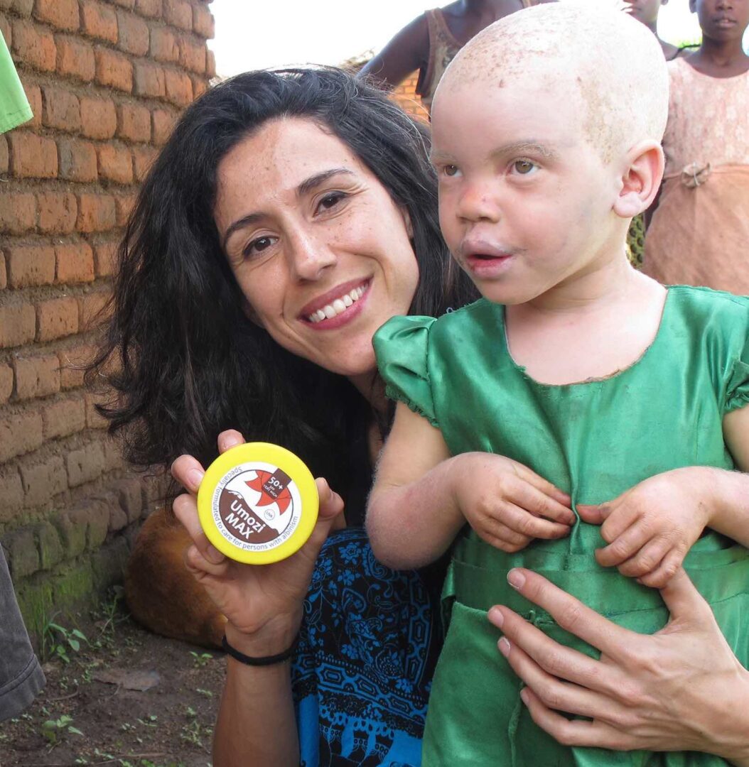 BASF and Beyond Suncare renew partnership to protect African people with albinism