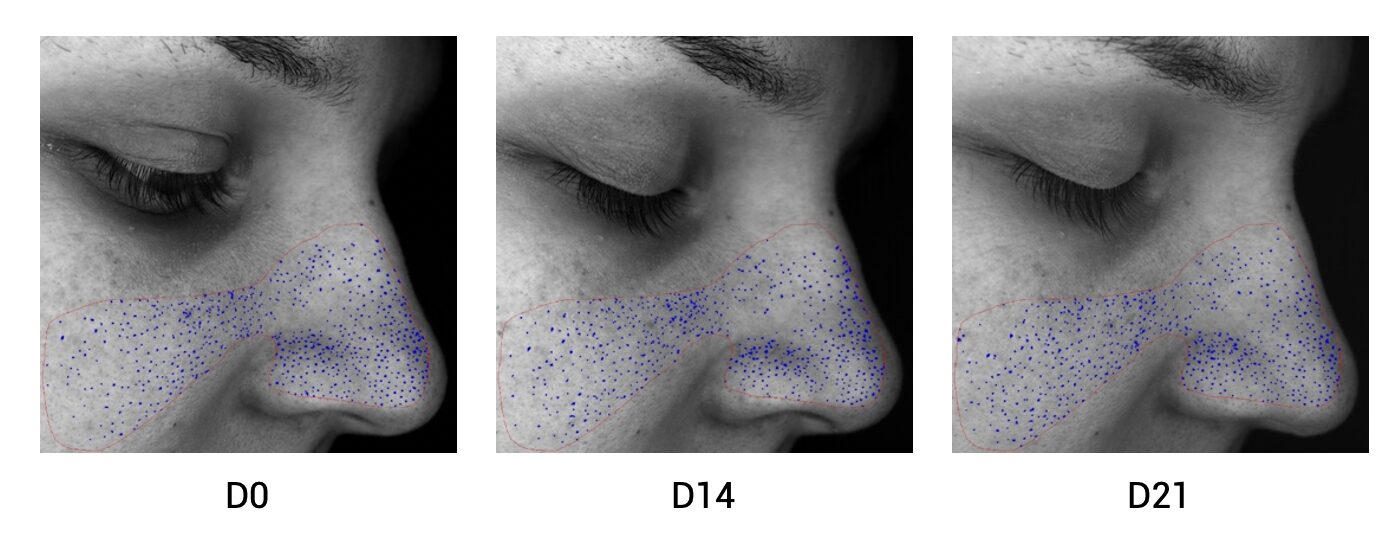 Novel tripeptide to control oily skin